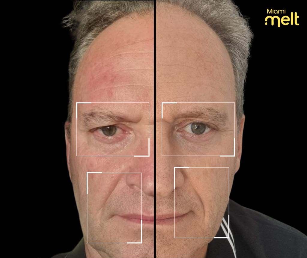 wonderface before and after male patient