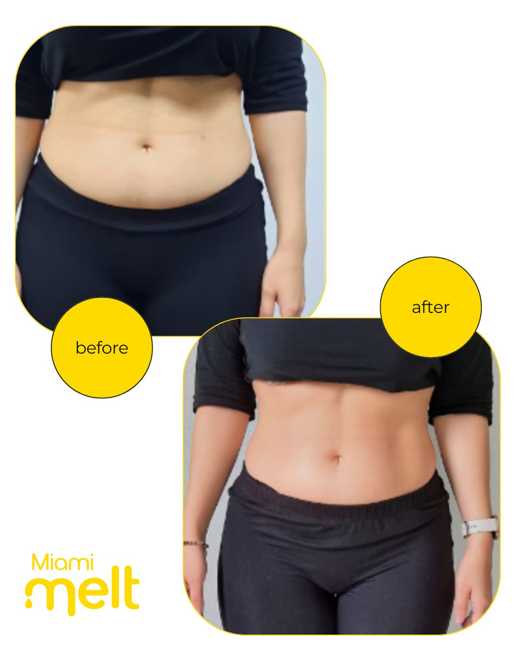 muscle toning Miami