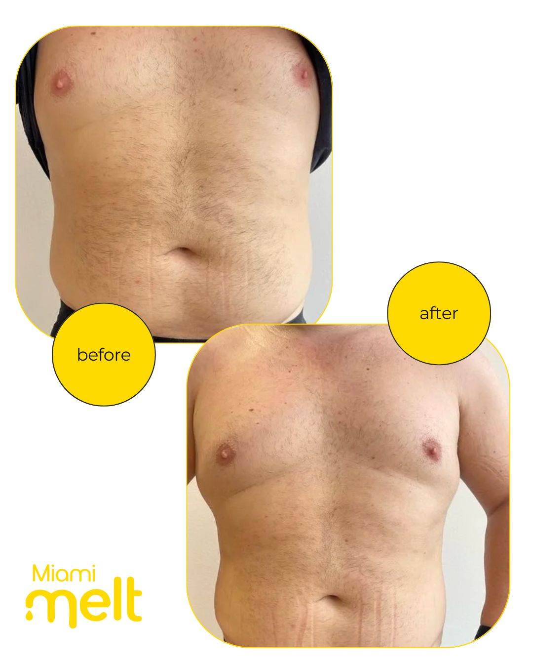 Onnafit muscle toning results