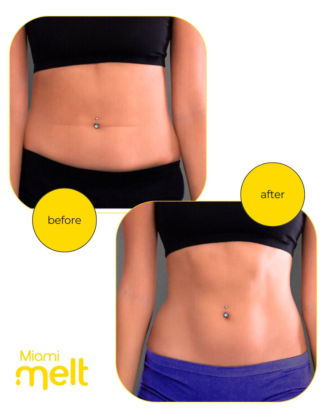 Mucle toning with Onnafit Miami