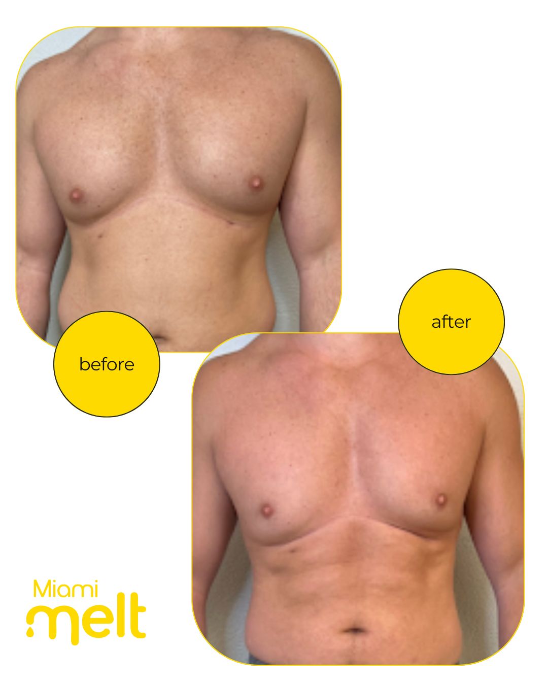 Onnafit results