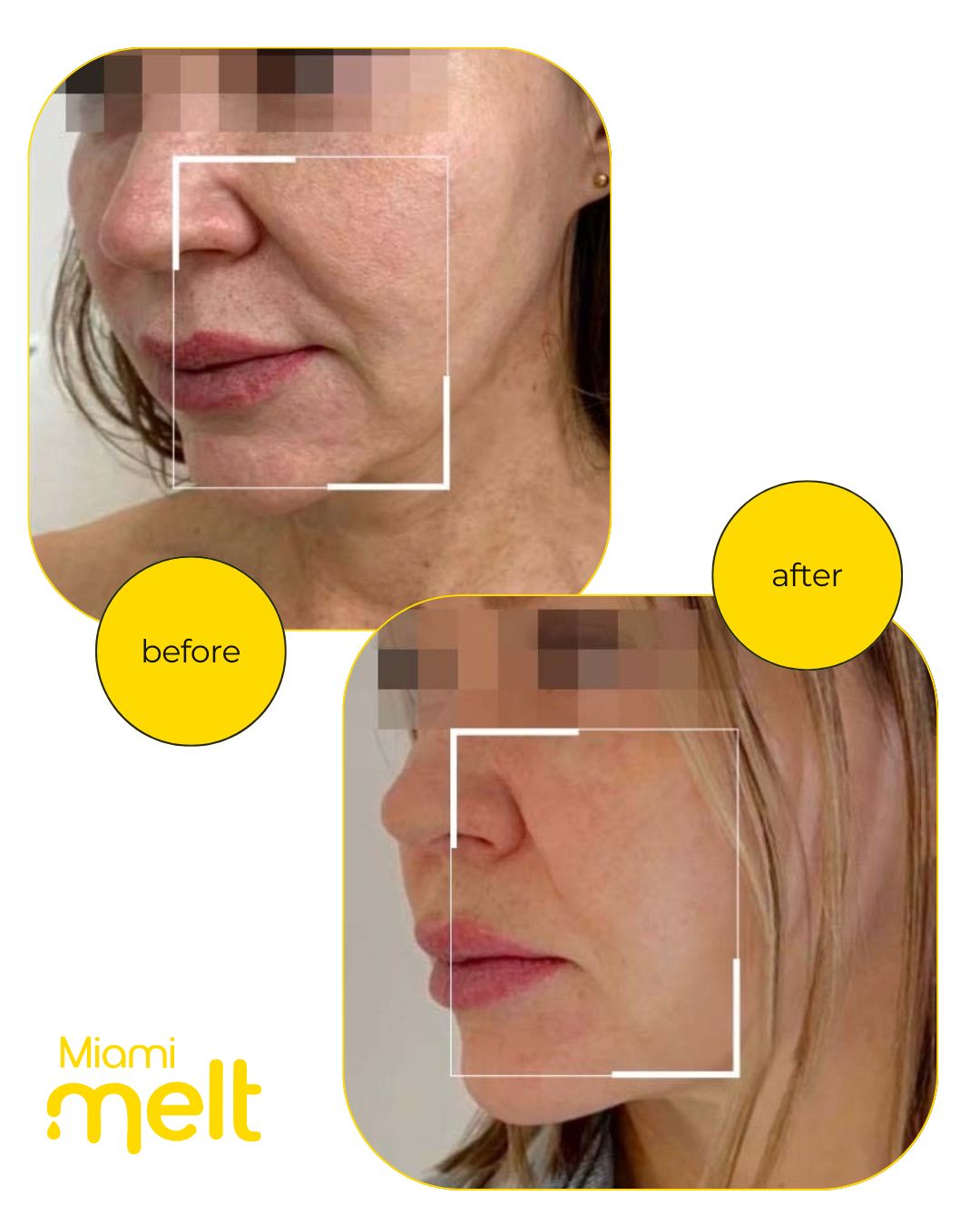 wonderface results