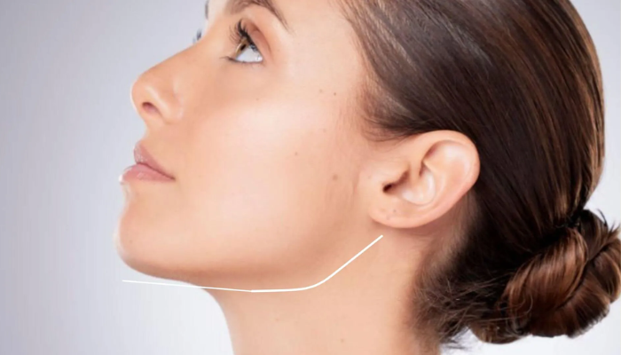 Non-Surgical Jawline Contouring